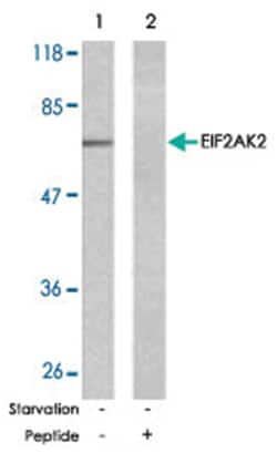 EIF2AK2 Rabbit anti-Human, Mouse, Polyclonal Antibody, Abnova 100 &mu;g | Buy Online | Abnova Corporation | Fisher Scientific