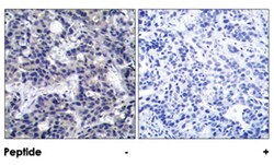 EIF2AK2 Rabbit anti-Human, Mouse, Polyclonal Antibody, Abnova 100 &mu;g | Buy Online | Abnova Corporation | Fisher Scientific