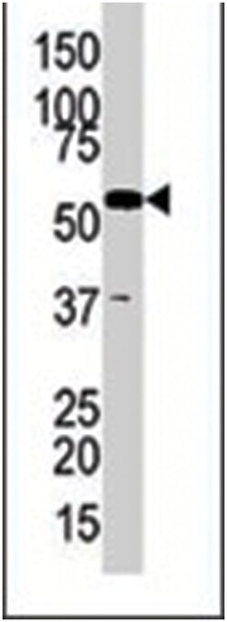 GK2, Rabbit, Polyclonal Antibody, Abnova 400 &mu;L | Buy Online | Abnova Corporation | Fisher Scientific