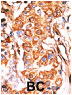 GK2, Rabbit, Polyclonal Antibody, Abnova 400 &mu;L | Buy Online | Abnova Corporation | Fisher Scientific