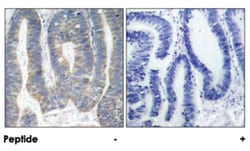 EIF2AK2 Rabbit anti-Human, Mouse, Polyclonal Antibody, Abnova 100 &mu;g | Buy Online | Abnova Corporation | Fisher Scientific