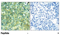 GAB1 Rabbit anti-Human, Mouse, Polyclonal Antibody, Abnova 100&mu;g; Unlabeled:Antibodies,