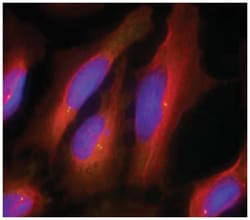 SYT1 Rabbit anti-Human, Mouse, Rat, Polyclonal Antibody, Abnova 100&mu;g;