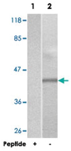 SYT1/SYT2, Rabbit, Polyclonal Antibody, Abnova 100&mu;g; Unlabeled:Antibodies,