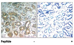 PTPN11 Rabbit anti-Human, Mouse, Rat, Polyclonal Antibody, Abnova 100&mu;g;