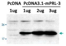 PTP4A3 Rabbit anti-Human, Mouse, Polyclonal Antibody, Abnova 100 &mu;g | Buy Online | Abnova Corporation | Fisher Scientific