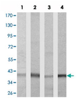 PPP2CA Rabbit anti-Human, Mouse, Rat, Polyclonal Antibody, Abnova 100 &mu;g | Buy Online | Abnova Corporation | Fisher Scientific