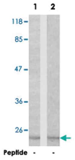 CFL1/CFL2 Rabbit anti-Human, Mouse, Polyclonal Antibody, Abnova 100 &mu;g | Buy Online | Abnova Corporation | Fisher Scientific