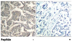 CFL1/CFL2 Rabbit anti-Human, Mouse, Polyclonal Antibody, Abnova 100 &mu;g | Buy Online | Abnova Corporation | Fisher Scientific
