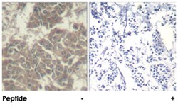 JAK2 Rabbit anti-Human, Rat, Polyclonal Antibody, Abnova 100&mu;g; Unlabeled:Antibodies,