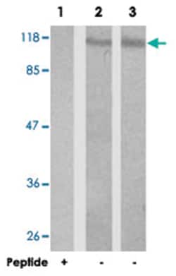 STAT2 Rabbit anti-Human, Polyclonal Antibody, Abnova 100 &mu;g | Buy Online | Abnova Corporation | Fisher Scientific