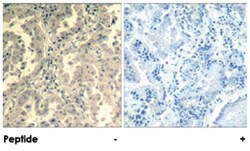 STAT2 Rabbit anti-Human, Polyclonal Antibody, Abnova 100 &mu;g | Buy Online | Abnova Corporation | Fisher Scientific