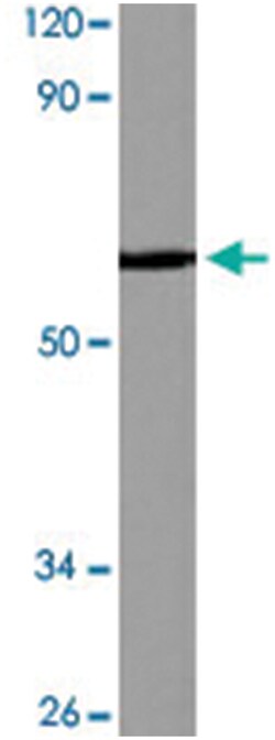 FXR2, Rabbit, Polyclonal Antibody, Abnova 100 &mu;L | Buy Online | Abnova Corporation | Fisher Scientific
