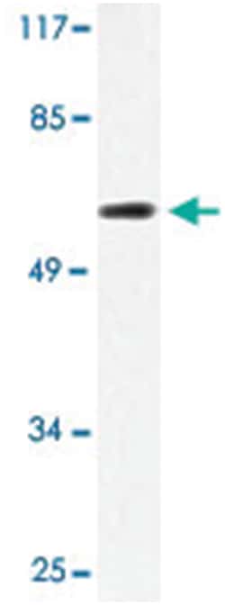 ELL, Rabbit, Polyclonal Antibody, Abnova 100&mu;L; Unlabeled:Antibodies,