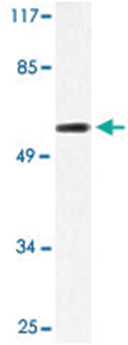 SP2, Rabbit, Polyclonal Antibody, Abnova 100&mu;L; Unlabeled:Antibodies,