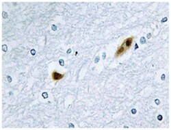 E2F2, Rabbit, Polyclonal Antibody, Abnova 100 &mu;L | Buy Online | Abnova Corporation | Fisher Scientific