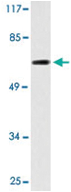 MAP3K3, Rabbit, Polyclonal Antibody, Abnova 100 &mu;L | Buy Online | Abnova Corporation | Fisher Scientific