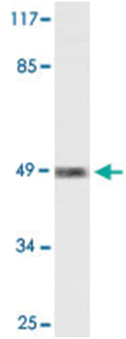 FOXD3, Rabbit, Polyclonal Antibody, Abnova 100 &mu;L | Buy Online | Abnova Corporation | Fisher Scientific