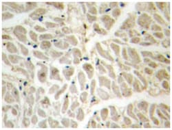 FOXD3, Rabbit, Polyclonal Antibody, Abnova 100 &mu;L | Buy Online | Abnova Corporation | Fisher Scientific