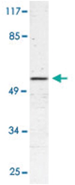 TRIM38, Rabbit, Polyclonal Antibody, Abnova 100 &mu;L | Buy Online | Abnova Corporation | Fisher Scientific