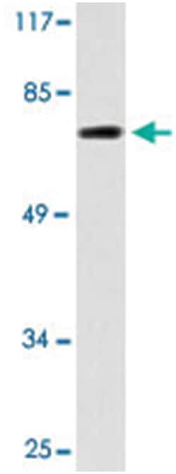 SKIL Rabbit anti-Human, Mouse, Polyclonal Antibody, Abnova 100&mu;L; Unlabeled:Antibodies,