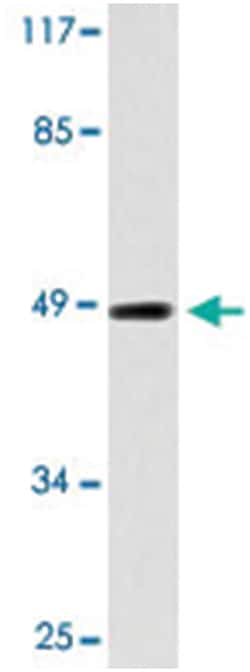 TMPRSS3, Rabbit, Polyclonal Antibody, Abnova 100&mu;L; Unlabeled:Antibodies,