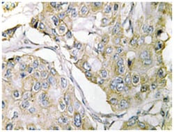 TMPRSS3, Rabbit, Polyclonal Antibody, Abnova 100&mu;L; Unlabeled:Antibodies,