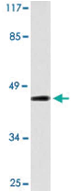 IRX1, Rabbit, Polyclonal Antibody, Abnova 100&mu;L; Unlabeled:Antibodies,