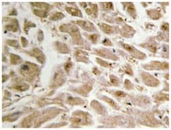 IRX1, Rabbit, Polyclonal Antibody, Abnova 100&mu;L; Unlabeled:Antibodies,