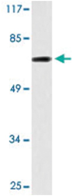 MED17, Rabbit, Polyclonal Antibody, Abnova 100&mu;L; Unlabeled:Antibodies,