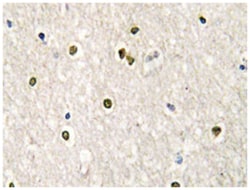MED17, Rabbit, Polyclonal Antibody, Abnova 100&mu;L; Unlabeled:Antibodies,