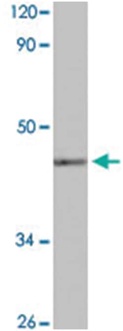 LMX1B Rabbit anti-Human, Mouse, Polyclonal Antibody, Abnova 100&mu;L; Unlabeled:Antibodies,