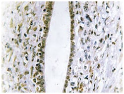 FES, Rabbit, Polyclonal Antibody, Abnova 100 &mu;L | Buy Online | Abnova Corporation | Fisher Scientific