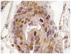 DIDO1, Rabbit, Polyclonal Antibody, Abnova 100 &mu;L | Buy Online | Abnova Corporation | Fisher Scientific