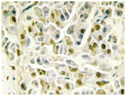RAD51L1, Rabbit, Polyclonal Antibody, Abnova 100&mu;L; Unlabeled:Antibodies,