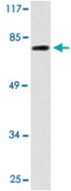 TACC3, Rabbit, Polyclonal Antibody, Abnova 100 &mu;L | Buy Online | Abnova | Fisher Scientific