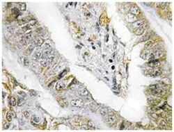 TACC3, Rabbit, Polyclonal Antibody, Abnova 100 &mu;L | Buy Online | Abnova | Fisher Scientific