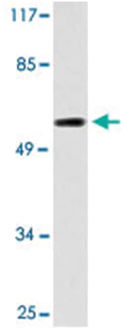 FZD10 Rabbit anti-Human, Mouse, Polyclonal Antibody, Abnova 100 &mu;L | Buy Online | Abnova Corporation | Fisher Scientific