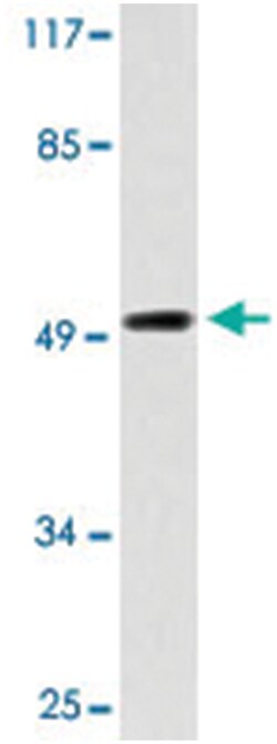 IL7R Rabbit anti-Human, Mouse, Polyclonal Antibody, Abnova 100&mu;L; Unlabeled:Antibodies,
