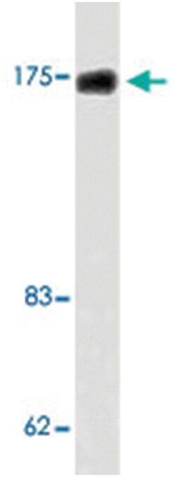 TOP2A Rabbit anti-Human, Mouse, Polyclonal Antibody, Abnova 100&mu;L; Unlabeled:Antibodies,