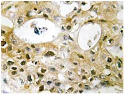 TOP2A Rabbit anti-Human, Mouse, Polyclonal Antibody, Abnova 100&mu;L; Unlabeled:Antibodies,