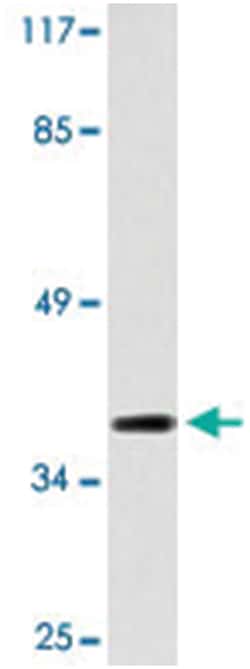 S1PR4 Rabbit anti-Human, Mouse, Polyclonal Antibody, Abnova 100 &mu;L | Buy Online | Abnova Corporation | Fisher Scientific