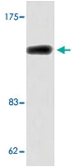 MAPK8IP3, Rabbit, Polyclonal Antibody, Abnova 100&mu;L; Unlabeled:Antibodies,
