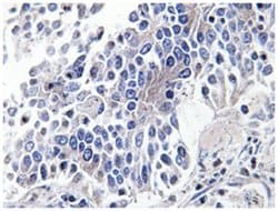MAPK8IP3, Rabbit, Polyclonal Antibody, Abnova 100&mu;L; Unlabeled:Antibodies,