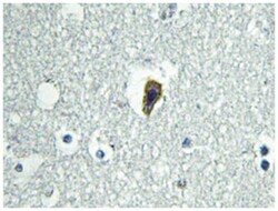 BAI1 Rabbit anti-Human, Mouse, Polyclonal Antibody, Abnova 100&mu;L; Unlabeled:Antibodies,