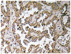 OR5H15, Rabbit, Polyclonal Antibody, Abnova 100&mu;L; Unlabeled:Antibodies,