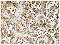OR4D1, Rabbit, Polyclonal Antibody, Abnova 100&mu;L; Unlabeled:Antibodies,