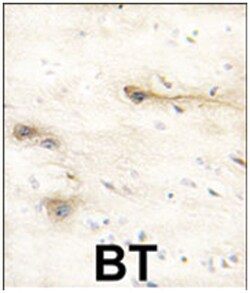 MARK1 Rabbit anti-Human, Mouse, Polyclonal Antibody, Abnova 400&mu;L; Unlabeled:Antibodies,