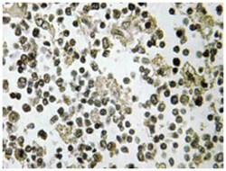 DDX55, Rabbit, Polyclonal Antibody, Abnova 100&mu;L; Unlabeled:Antibodies,