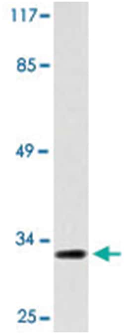 CNN2, Rabbit, Polyclonal Antibody, Abnova 100&mu;L; Unlabeled:Antibodies,